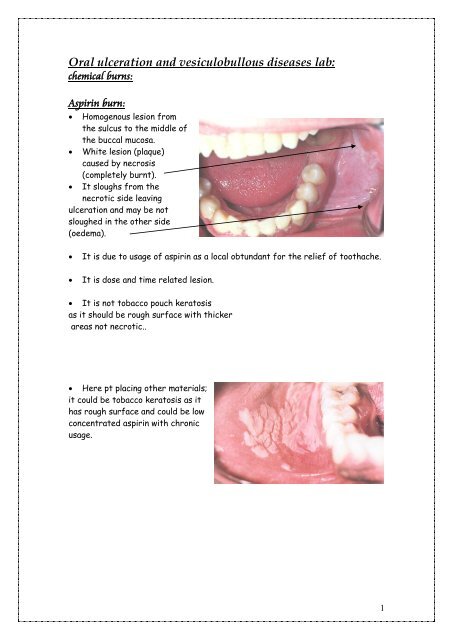 alexis cokes add rough oral photo