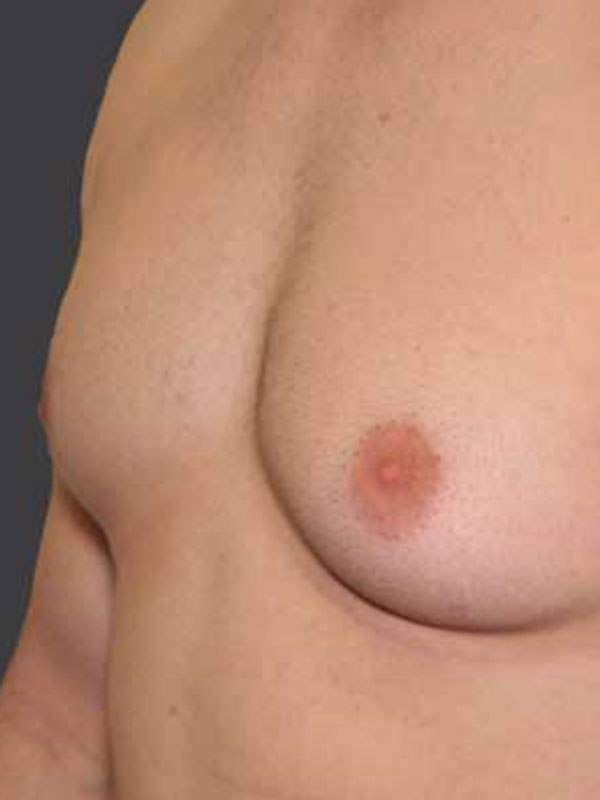 ben allott add puffy women nipple image