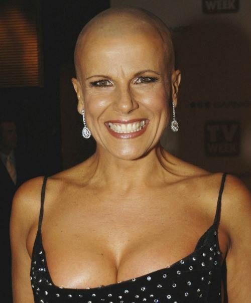 dale goble add milf bald photo