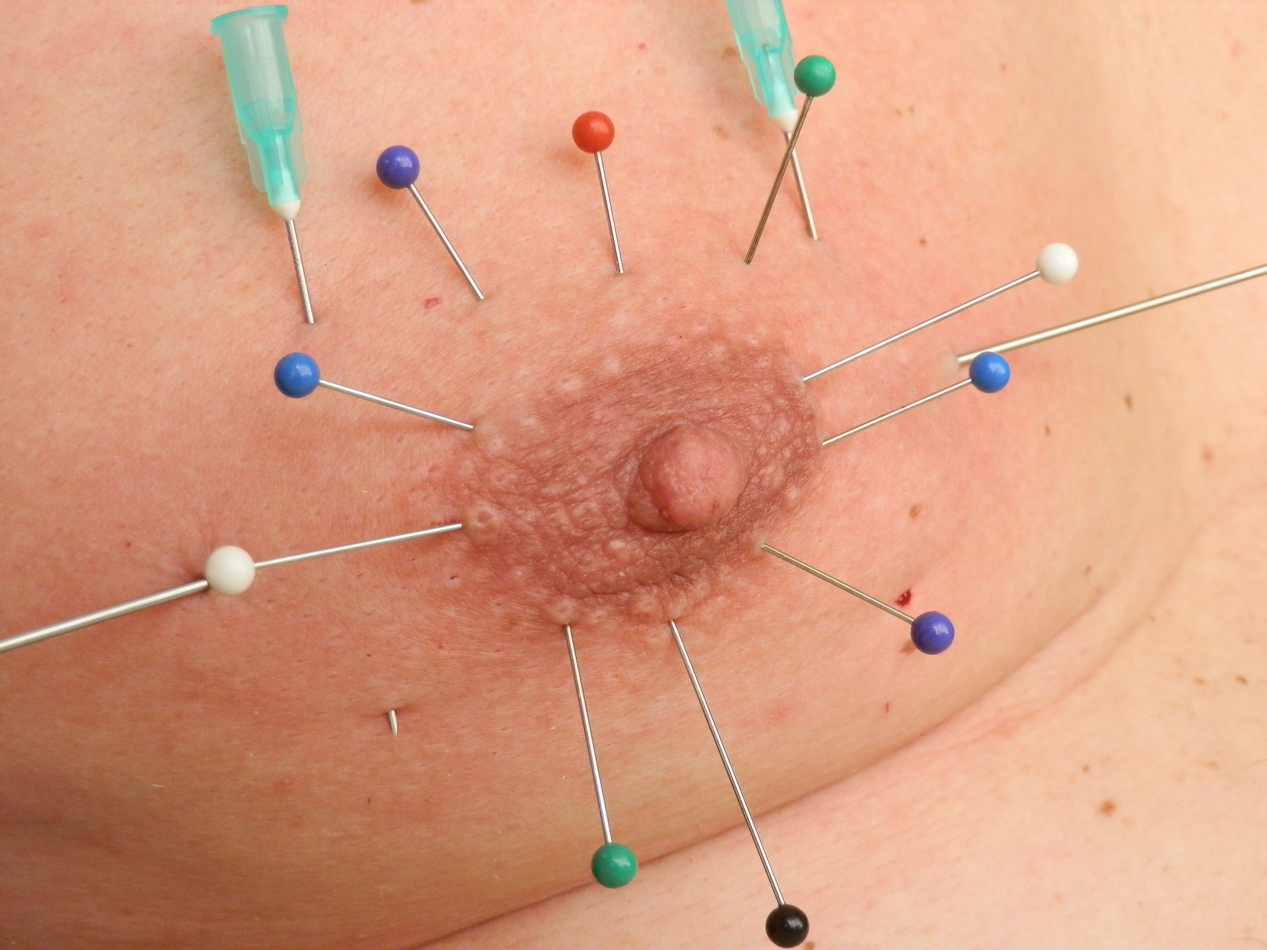 agus black add nipple needle torture photo