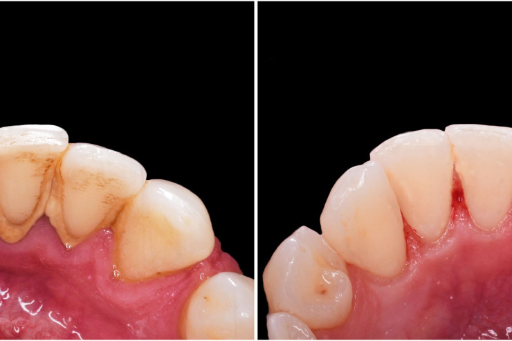 aleksandar panovski add rough oral image