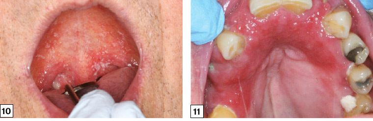 devin narine add rough oral photo