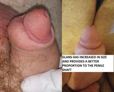 dipa rana add big head penises photo