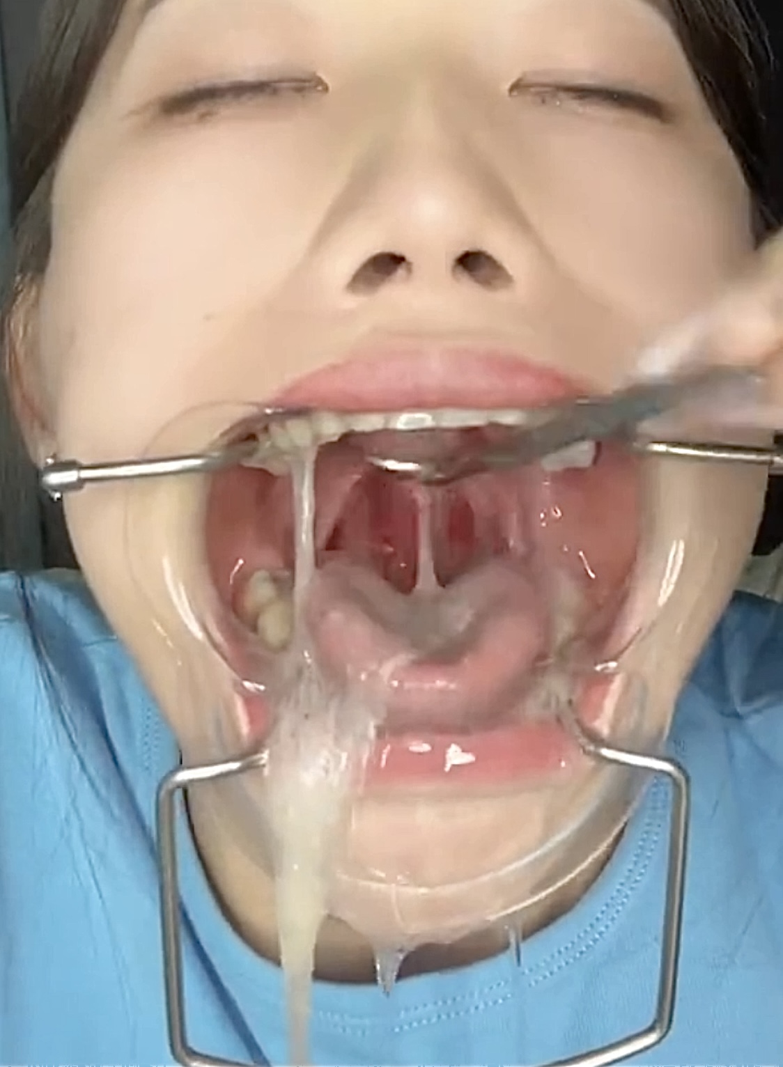 bill reiners add asian throat gagging photo