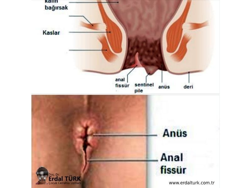 alison lejeune add turk anal image