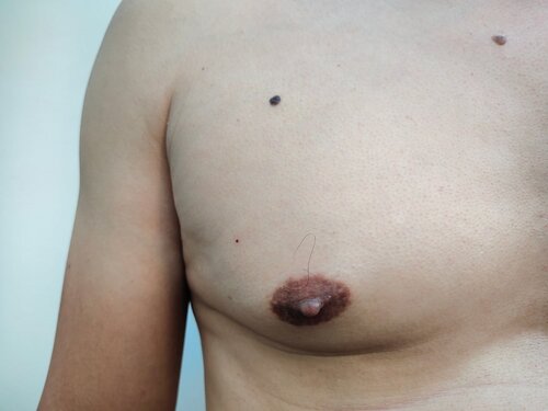 anthony j ortiz add fat black nipple photo