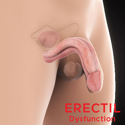 deanna ratcliffe add male erection picture photo